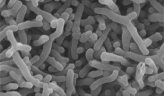 ビフィズス菌 OLB6378の顕微鏡写真