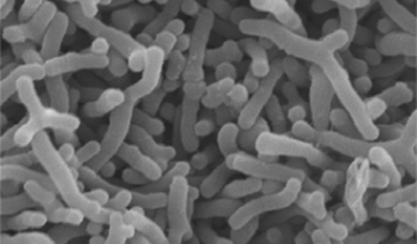 ビフィズス菌 OLB6378の顕微鏡写真