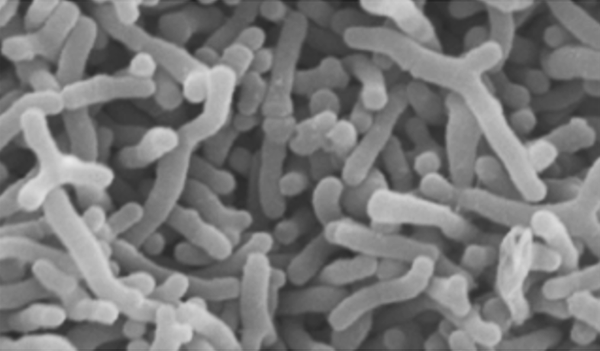 ビフィズス菌（B. bifidum OLB6378）の顕微鏡写真