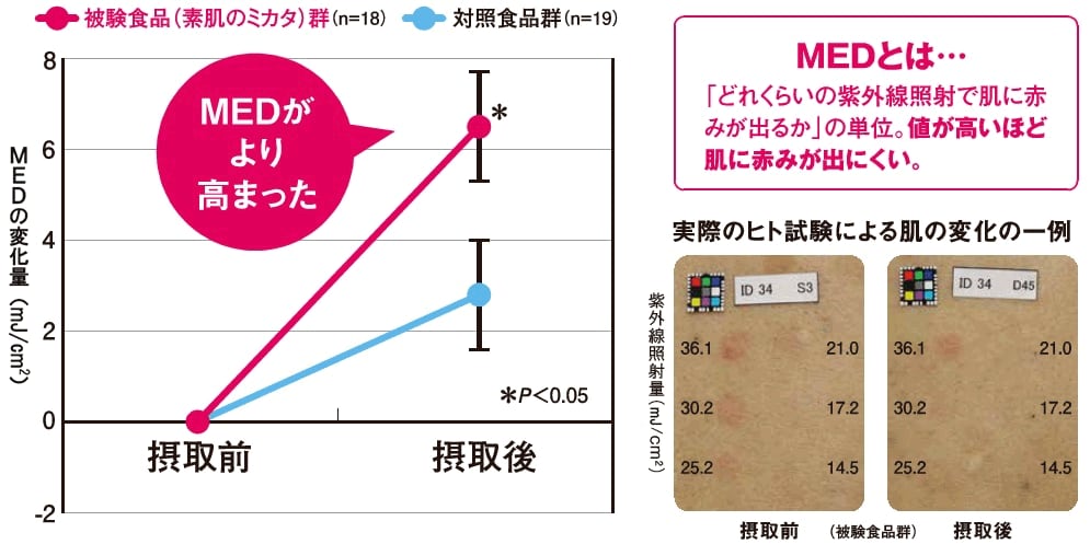 MEDとは・・・「どれくらいの紫外線照射で肌に赤みが出るか」の単位。値が高いほど肌に赤みが出にくい・グラフ：被験食品摂取後、MEDがより高まったことを示す・写真：実際のヒト試験による、被験食品摂取接種前後の肌の変化の一例の写真