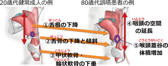 高齢者や嚥下障害者に適した商品開発への利活用