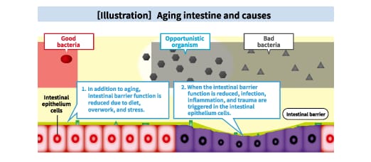 Reference: [Illustration] Intestinal aging and its cause