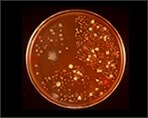 Culturing adult stool on BL agar plates