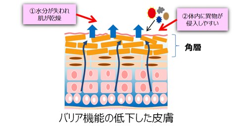 バリア機能の低下した皮膚