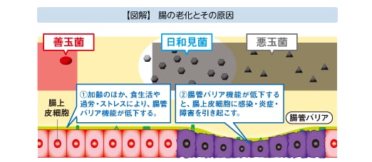 【図解】腸の老化とその原因