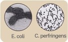 E. coli C. perfringens