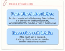 Cause of swelling