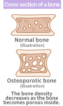 Cross section of a bone