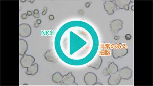 （動画）NK細胞が異常のある細胞を攻撃する様子