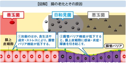 【図解】腸の老化とその原因