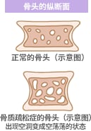 骨头的纵断面